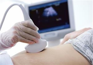 صورة.. ذهول أم عندما رأت جنينها على شكل سيارة!