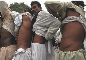 في الهند.. سرقة أعضاء المتبرعين والكلية ب3 آلاف جنيه استرليني