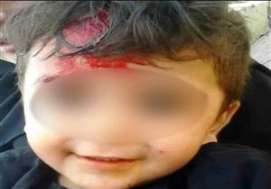 القبض على أم اعتدت على طفلتها "بماسورة" وأصابتها بنزيف في المخ