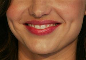 سلي صيامك| تعرف على السر وراء الغمازات