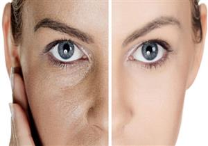  أسباب وحلول مسام البشرة الكبيرة