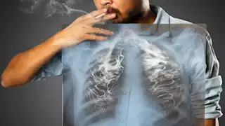 دراسة علمية تكشف كيف يؤثر التدخين على صحة الرئتين