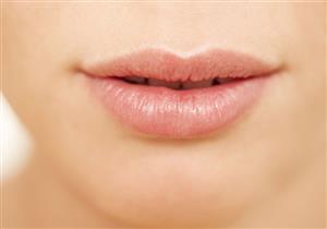 تشقق زوايا الفم.. الأسباب والعلاج