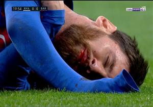  بالفيديو.. إصابة دامية لميسي خلال مباراة الكلاسيكو 