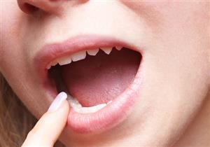 هذه العلامات تنذر بسرطان الفم