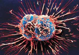  صحتك في رمضان| أبرزها السرطان.. احذر هذا الأمر قد يكون علامة على 6 مشاكل صحية