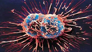 10 أعراض قد تكشف إصابتك بالسرطان.. لا تتجاهلها