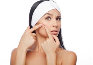 هل تعاني من حب الشباب؟ إليك الحل 