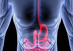  8 نصائح لمرضى القولون العصبي في رمضان