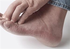 هل تعاني من آلام في باطن الساق أثناء المشي؟.. إليك السبب