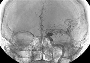 معجزة علمية.. إيقاظ رجل من غيبوبة استمرت 15 سنة
