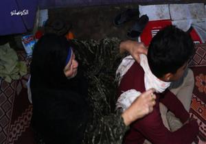 «الخنق» طريقة أهل الريف لعلاج «القَرفة».. وطبيب يُعلق