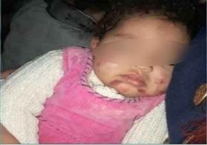 والد رضيعة يتهم حضانة في الخانكة بتعذيبها