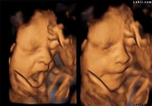 هل يتثاءب الجنين في رحم أمه؟..دراسة تجيب