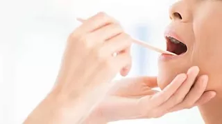 علامة مبكرة تدل على الإصابة بسرطان الفم والحلق