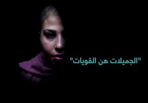 الجميلات هن القويات.. سرطان الثدي مرض مراوغ يُمكن هزيمته (كروس ميديا)