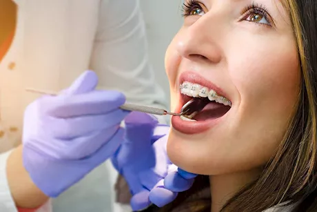 كيف تختار التقويم المناسب لأسنانك؟ طبيب يوضح 