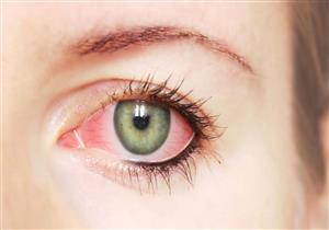  حالة العين تكشف أوضاع أعضاء الجسم الأخرى.. كيف ذلك؟