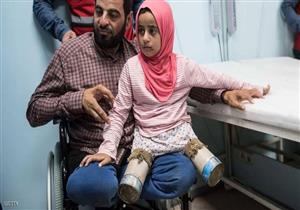 "مايا".. طفلة سورية استبدلت المعلبات الفارغة بأرجلها