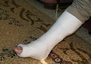 الطفل المعتدى عليه بمدرسة في المحلة :"معلم الرياضيات كسر قدمي من غير سبب"