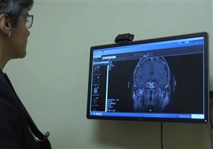 مضاعفات خطيرة لورم الغدة النخامية.. هل يتحول لسرطان؟