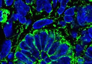 علماء يكونون أنسجة جديدة قد تعالج أمراض الكلى
