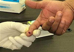 الصحة: مسح طبي بجميع أنحاء الجمهورية للقضاء على فيروس c