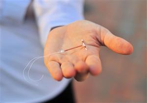 ما فوائد استخدام «اللولب النحاسي» لمنع الحمل؟