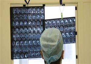 جراحون هنود ينجحون في إزالة «أكبر ورم دماغي».. كم يزن؟