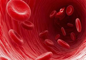 ما العلاقة بين الأنيميا وأمراض القلب؟