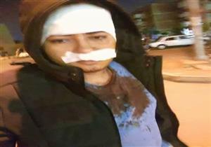 ضحية "التسوق الإلكتروني" يروي لـ"مصراوي" تفاصيل نجاته من الموت