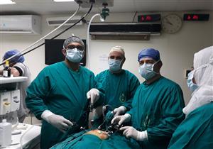 بالصور-  إزالة ورم من بطن رضيعة بلغ ربع وزنها في الدقهلية