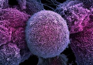 اكتشاف بروتين بالجسم مضاد للسرطان