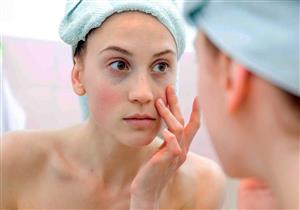  6 أسباب لانتفاخات تحت العيون.. بينها مشكلات الكبد