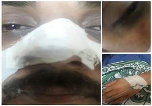 أقارب مريضة يضربون طبيبًا بدمياط: "قطع شريان رحمها"