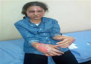 اتهام إمام خطيب بالتحريض على حرق طفلة ووالدها في الشرقية