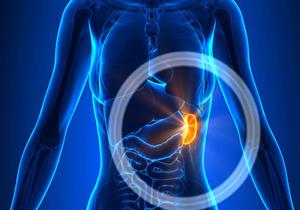 «تضخم الطحال» عرض وليس مرض.. متى يجب استئصاله؟