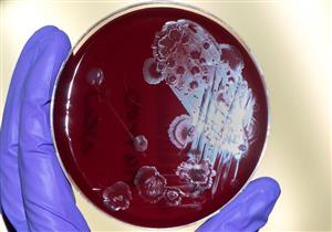 فشلت المضادات الحيوية في علاج هؤلاء المرضي ونجحت بكتيريا البراز 