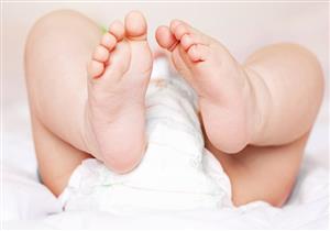 متى تستدعي القدم المخلبية عند الأطفال التدخل الجراحي؟