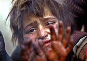 "الوزراء" يكشف حقيقة استخدام 35 طفلًا في دار أيتام بتجارة الأعضاء