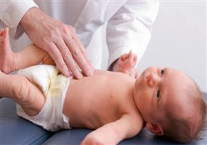 أسباب الوصلة الشريانية عند حديثي الولادة وطرق علاجها