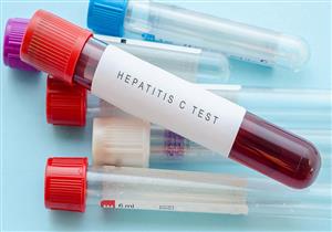 "مكافحة الفيروسات": تعاقدنا على 45 ألف علبة مصل جديد لعلاج منتكسي "فيروس سي"