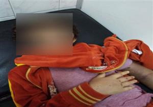 توقف وصول الدم للذراع.. العثور على طفلة بعد تعرضها للتعذيب بالشرقية