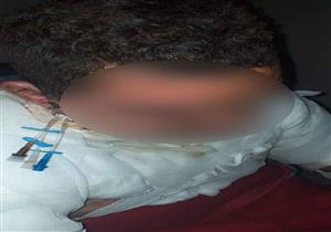 حبس سائق لاتهامه بإشعال النيران في جسد زميله بالشرقية