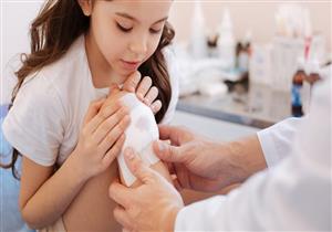  ٧ عادات خاطئة للتعامل مع الإصابات.. أبرزها الثلج لعلاج الحروق (فيديوجراف)