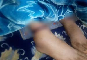  حلق رأسها وصورها عارية.. انتقام بشع من دليفري بحق زوجته