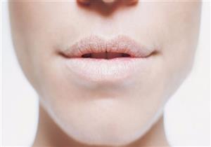 وصفات طبيعية لمحاربة تشقق الشفاه
