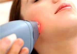 نقاط مهمة عند إزالة الشعر بالليزر