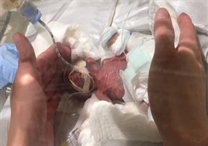 "أصغر رضيع" في العالم يغادر مستشفى في طوكيو