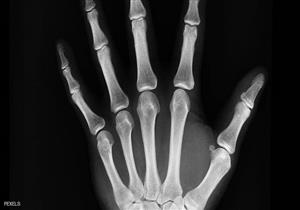 7 نصائح لحماية عظامك مع التقدم في العمر